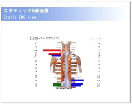 筋電計での背中の筋肉の緊張度合いのチェックの画像
