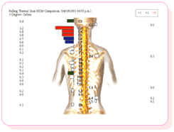 サーモグラフでの姿勢の神経活動のチェックの画像